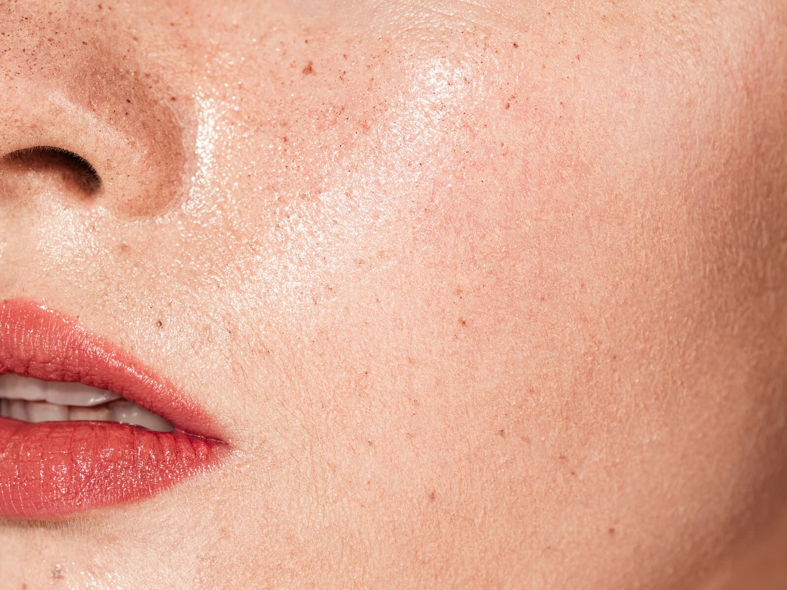 A close view of a woman's cheek, freckled and lightly flushed, with the corner of her mouth at the edge of the frame